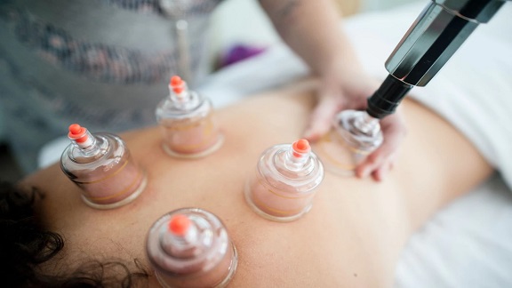 What is cupping therapy, how is it used?