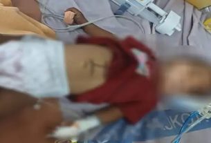 Untitled 46 શરદી, ઉધરસ થતા દિકરીને દવાની જગ્યાએ ડામ દિધા, બાળકીને ગંભીર હાલતમાં હોસ્પિટલ ખસેડાઈ
