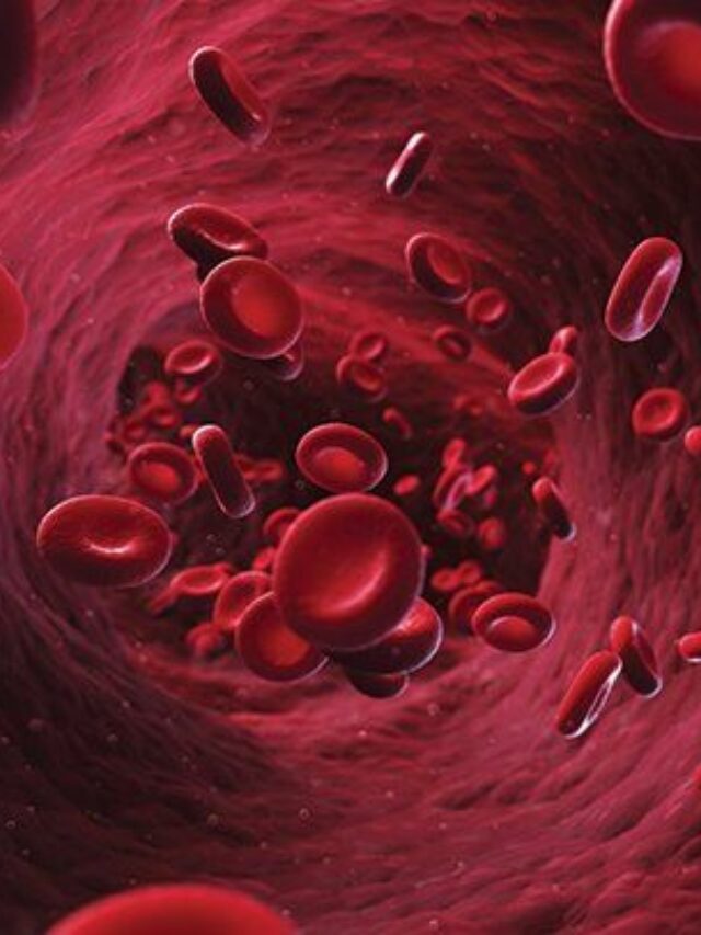 cs-anemia-722x406