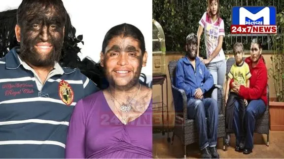 ગિનિસ વર્લ્ડ રેકોર્ડ્સે આ પરિવારની તસવીર શેર કરી ,જેમના ચહેરા અને આખા શરીર પર લાંબા વાળ ઉગેલા છે