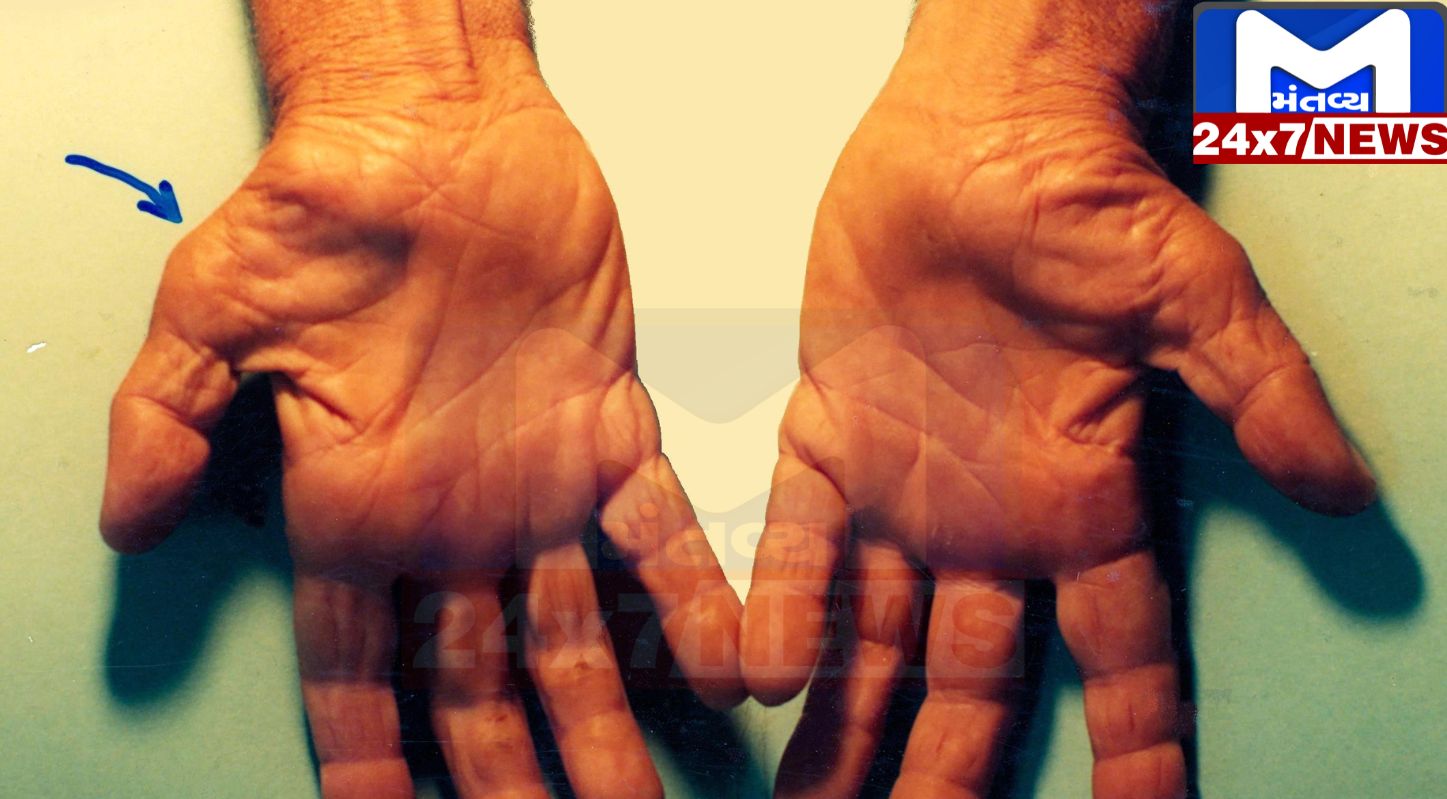 હાથ અને આંગળીઓમાં દુ:ખાવો થાય છે? તરત જ ડોક્ટરની સલાહ લો