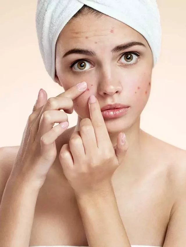How-To-Get-Rid-Of-Hard-Pimples.jpg