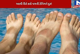 Learn home remedies to remove foot tan.