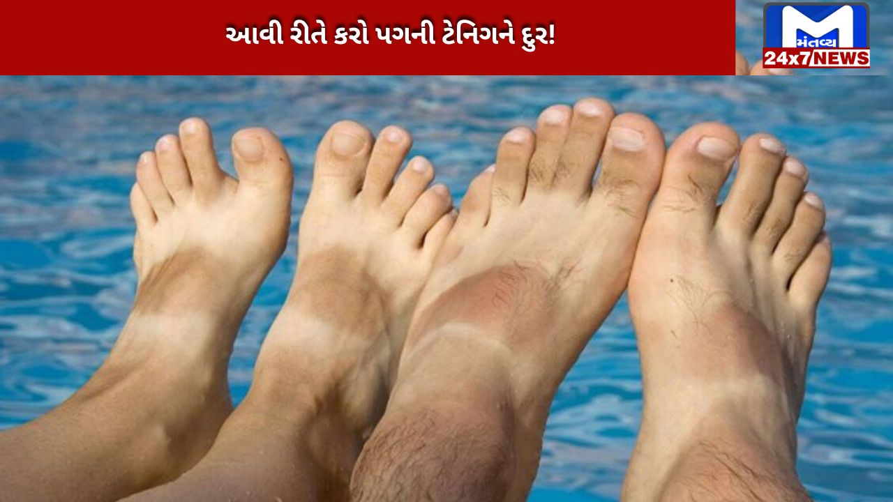 Learn home remedies to remove foot tan.