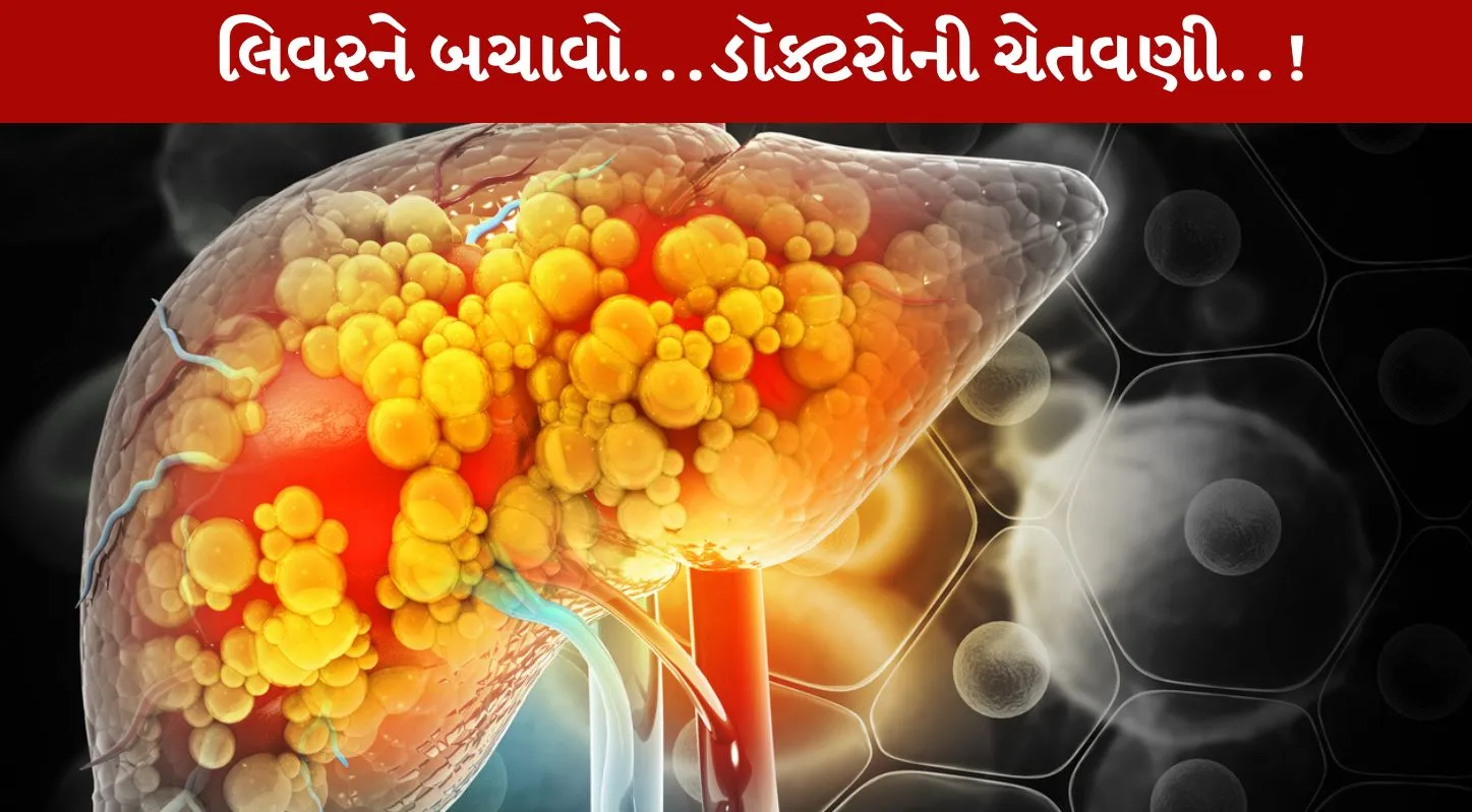 ફેટી લિવર, ડૉક્ટર