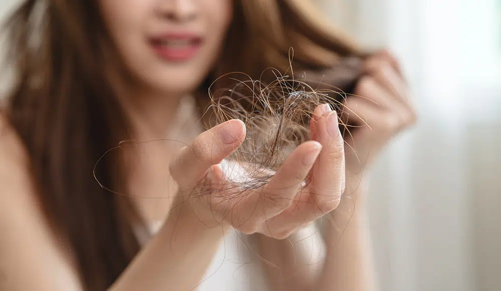 Hair loss