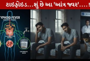 Typhoid, ટાઇફોઇડ, ફીવર, લક્ષણો, સારવાર, ટિપ્સ