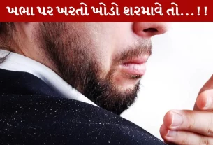 Dandruff, ખોડો, વાળ, એલોવેરા, ટિપ્સ