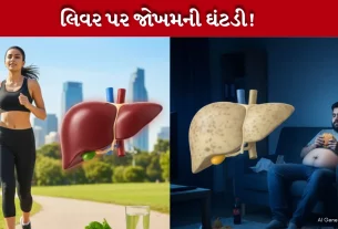 Fatty Liver