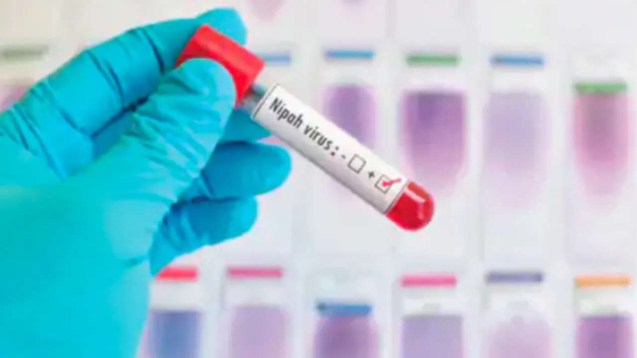 Nipah Virus