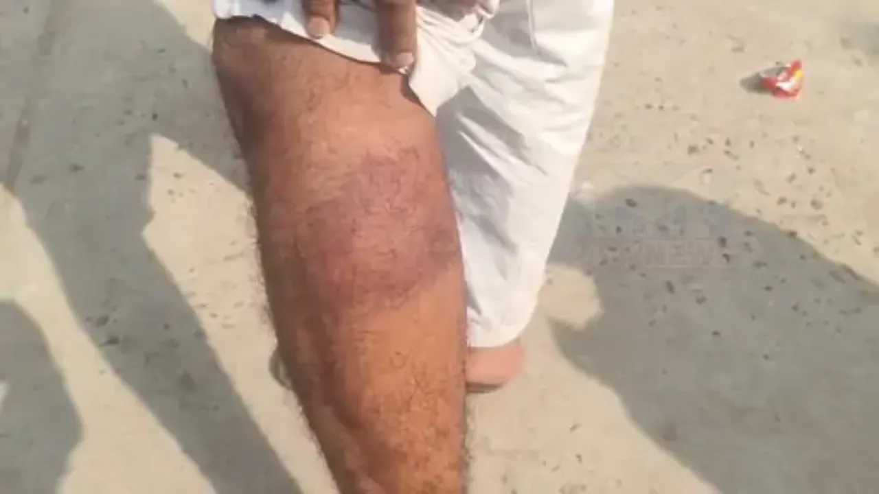 Mehsana Dalit Student Attack