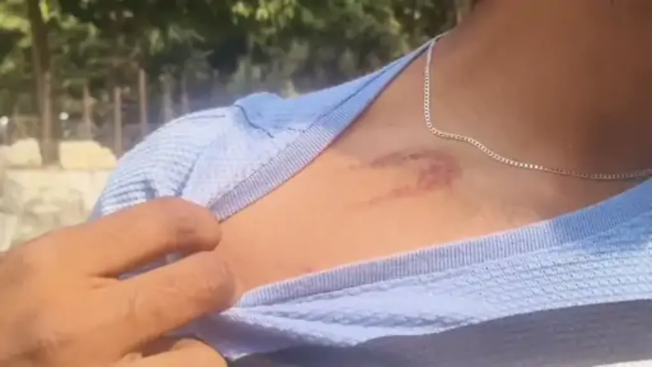 Mehsana Dalit Student Attack