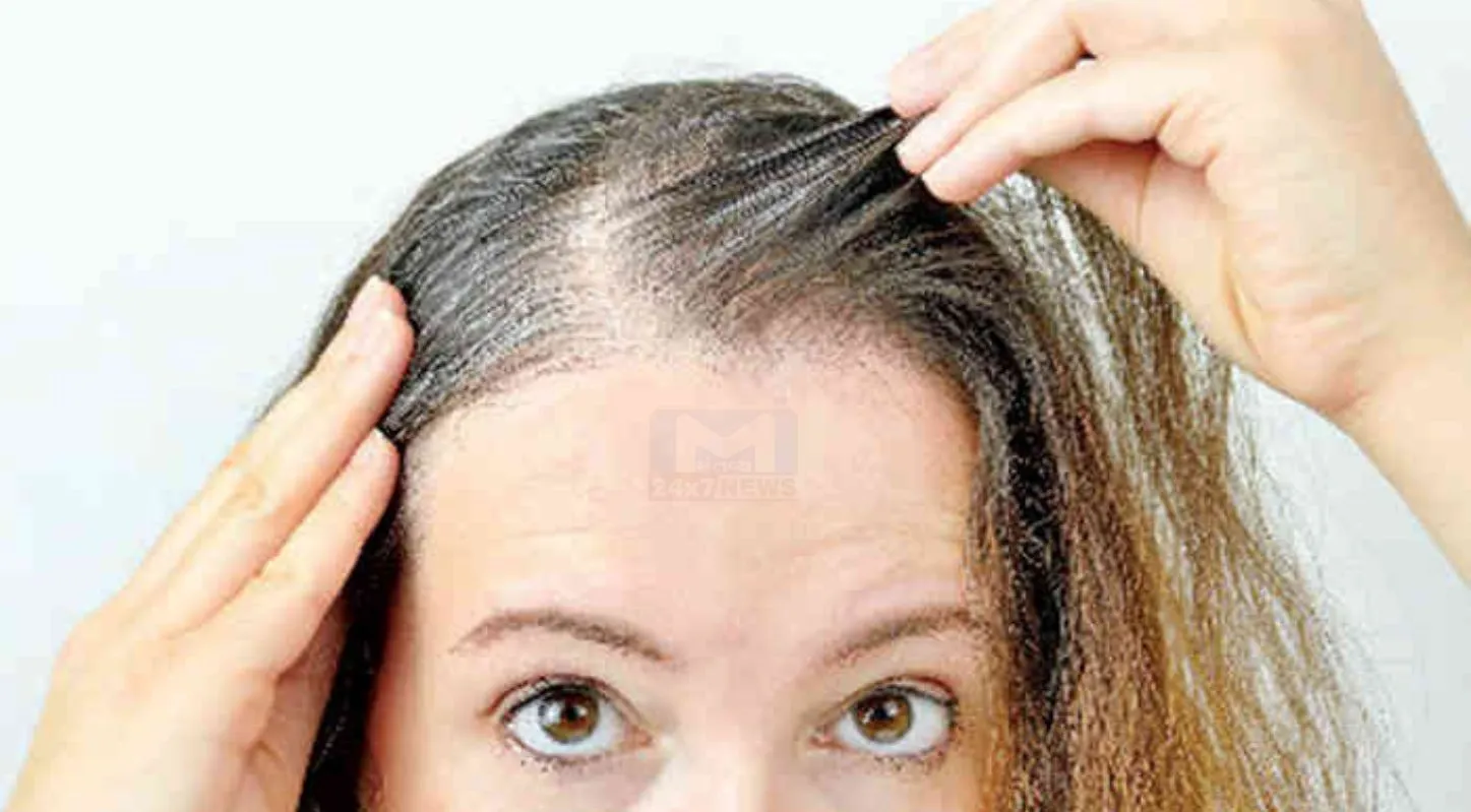 Hair Problems, વાળની સમસ્યાઓ, મેથી-સરસવનું તેલ, ખોડો, સ્કૅલ્પ ઇન્ફેક્શન