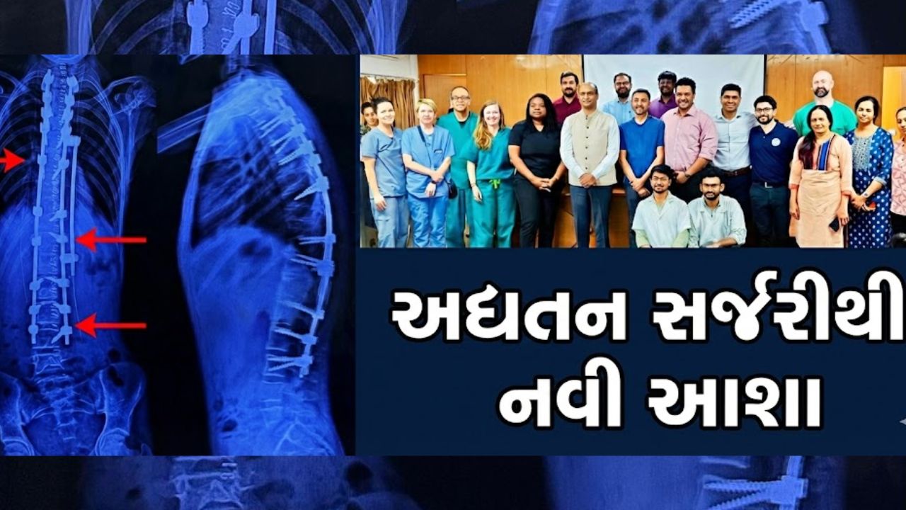 7 બાળકોની જટિલ spinal cord સર્જરી સફળ!