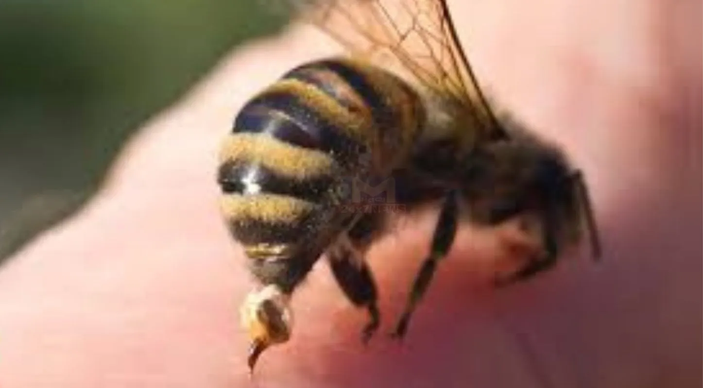 Bee Sting, જીવલેણ, બાળકો, ઇમ્યૂનિટી, મધમાખીનો દંશ
