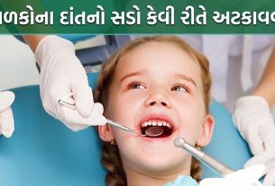 Tooth Decay