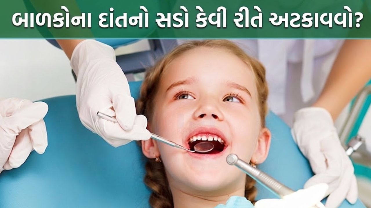 Tooth Decay