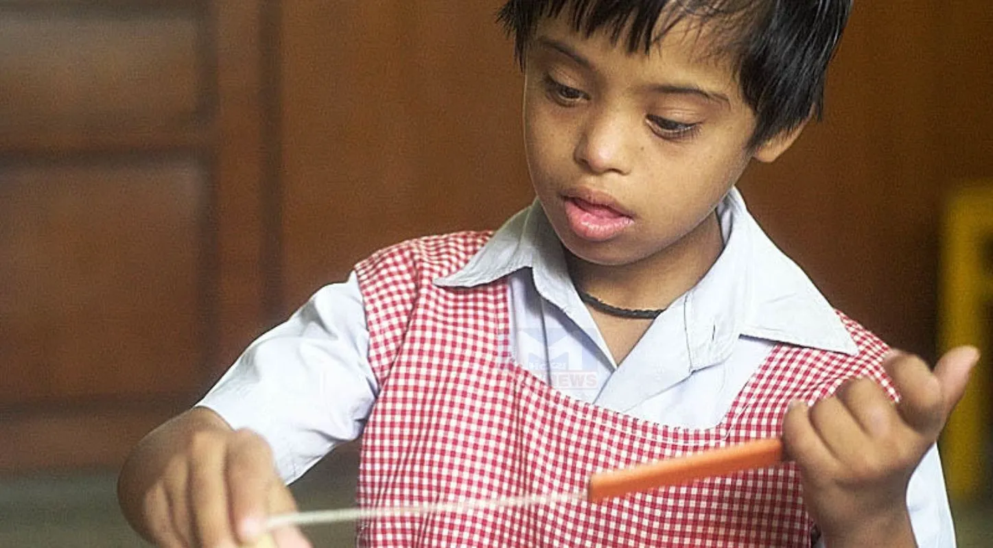 World Down Syndrome Day, ચપટો ચહેરો, તિરછી આંખ, આનુવંશિક વિકાર, બાળક