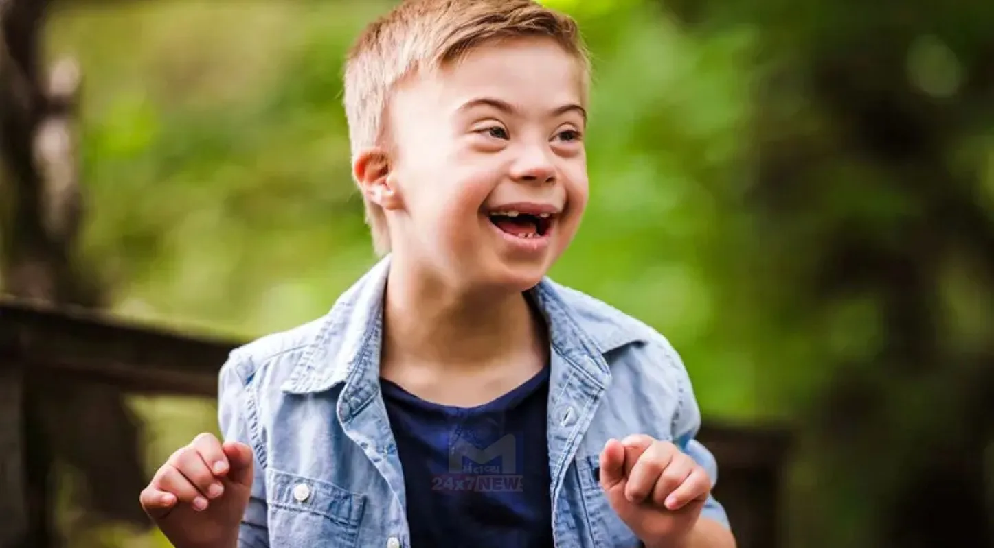 World Down Syndrome Day, ચપટો ચહેરો, તિરછી આંખ, આનુવંશિક વિકાર, બાળક