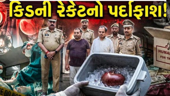 કાનપુરમાં કિડની રેકેટ(Kidney Scam) કેસમાં તાજેતરના ખુલાસાઓ ચોંકાવનારા રહ્યા છે
