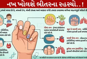 Nails, સ્વાસ્થ્ય, લીવર સમસ્યા, નખના સફાદ ધબ્બા, પીળા નખ