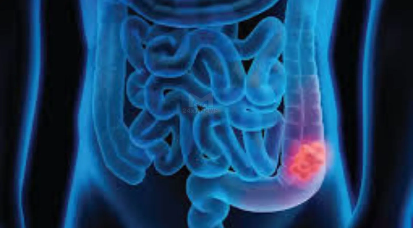 Obesity , જીવનશૈલી, કેન્સરના દર્દી, ઉપચાર, યૂકે