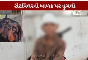 લાડ સોસાયટીમાં ખુલ્લા ફરતા રોટવિલર (Rottweiler) ડોગે 9 વર્ષના બાળક પર હુમલો કરતાં તેને માથા અને આંખના ભાગે ગંભીર ઇજાઓ પહોંચી હતી