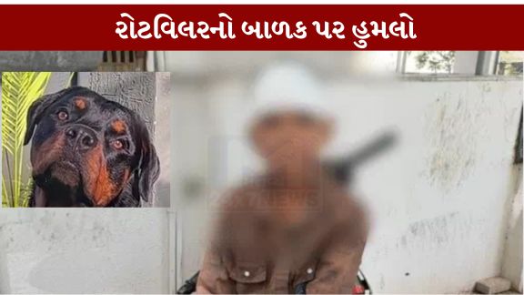 લાડ સોસાયટીમાં ખુલ્લા ફરતા રોટવિલર (Rottweiler) ડોગે 9 વર્ષના બાળક પર હુમલો કરતાં તેને માથા અને આંખના ભાગે ગંભીર ઇજાઓ પહોંચી હતી