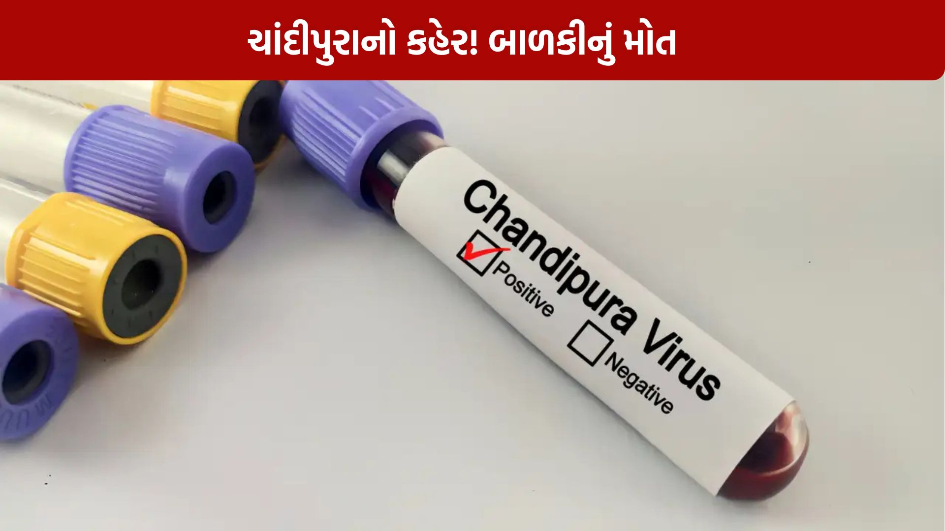 Chandipura virus