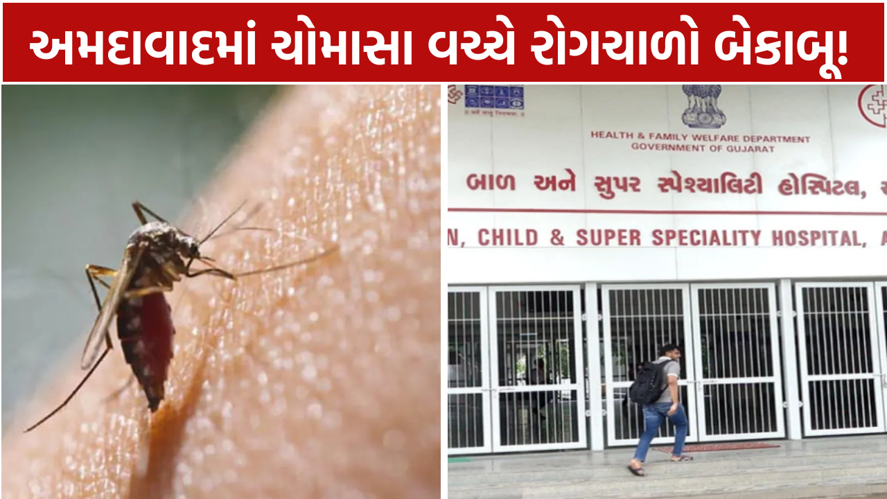 Monsoon Diseases: અમદાવાદમાં રોગચાળો બેકાબૂ