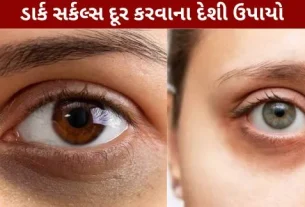 Get permanent relief from dark circles.