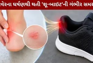 The serious problem of 'shoe-bite' caused by footwear friction.