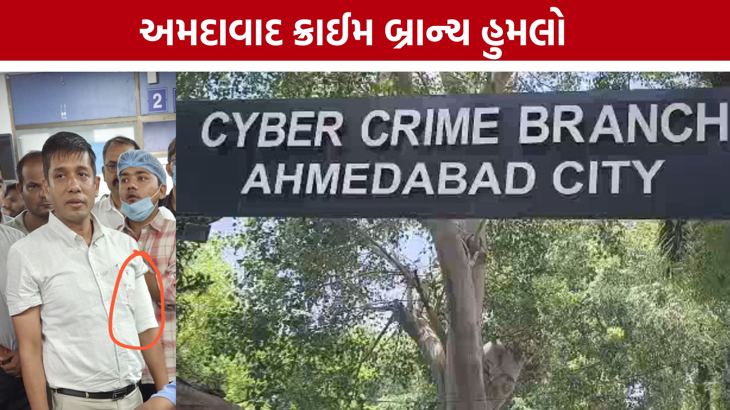 Ahmedabad Crime Branch:ચંડોળા તળાવ વિસ્તારમાં પોલીસ-આરોપી વચ્ચે ગોળીબાર
