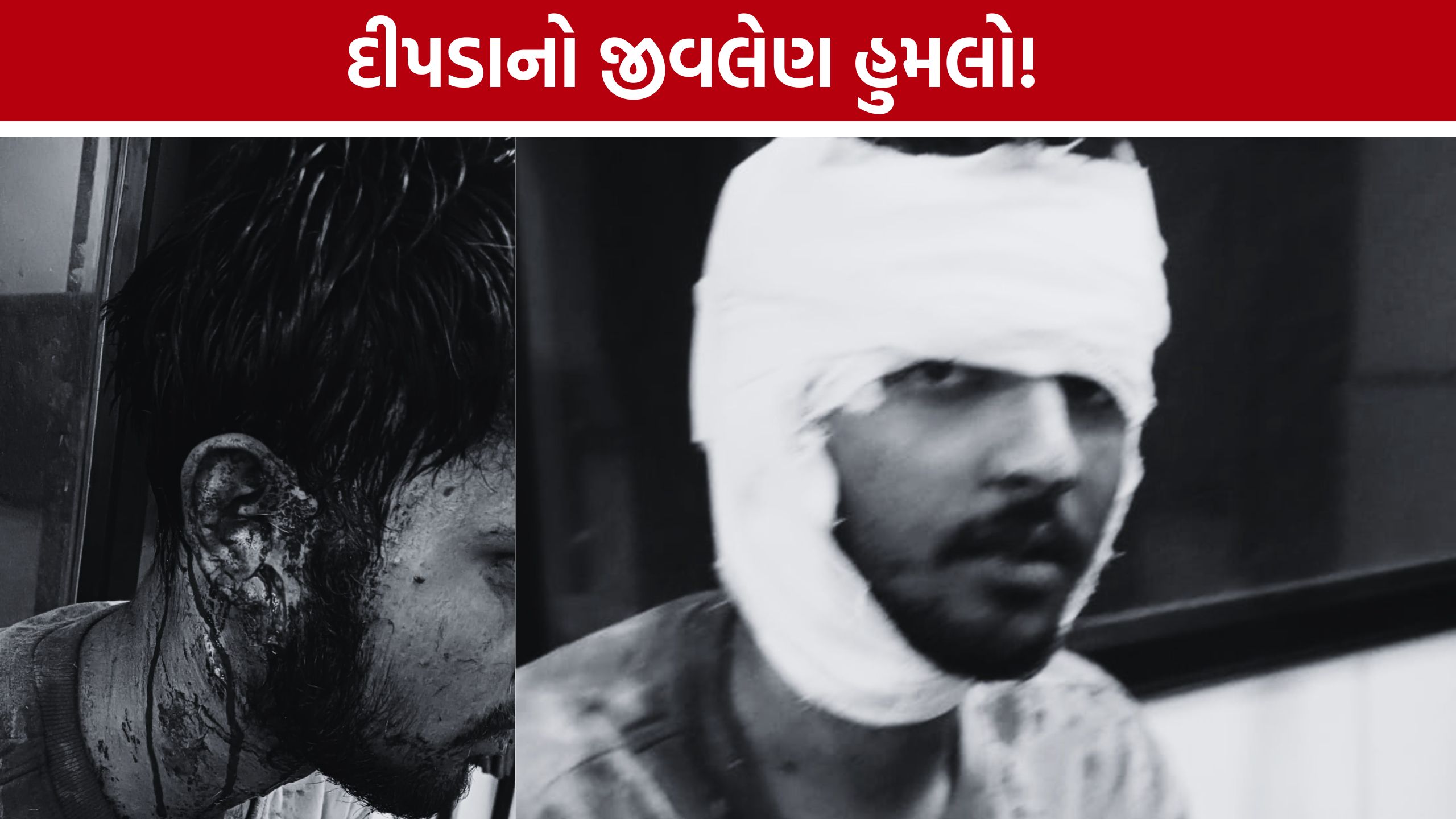 Gir Somnath Leopard Attack:ધોરણ-12ના વિદ્યાર્થીને વિમ્સ હોસ્પિટલ ખસેડાયો
