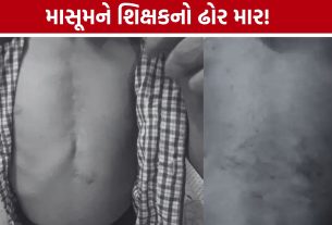 Student Beating Case:ઓપન હાર્ટ સર્જરી થયેલા 6 વર્ષના બાળકને સોટીથી માર