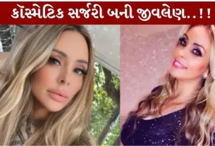 Cosmetic Surgery...એકસાથે 6 સર્જરીથી બ્રાઝીલની મહિલાનું મોત!