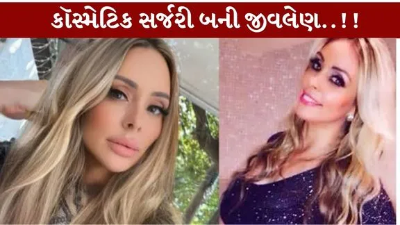 Cosmetic Surgery...એકસાથે 6 સર્જરીથી બ્રાઝીલની મહિલાનું મોત!