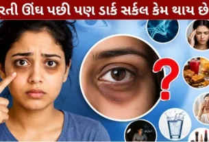 Why do dark circles appear even after getting enough sleep