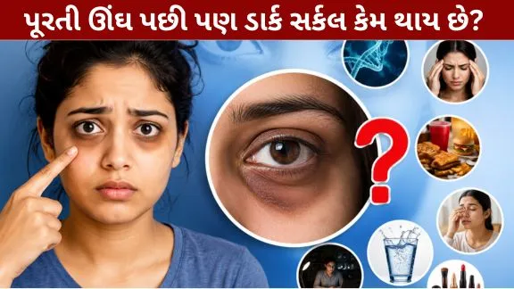 Why do dark circles appear even after getting enough sleep