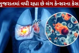 1 ઓગસ્ટ વિશ્વ લંગ કેન્સર દિવસ 2026 (World Lung Cancer Day 2026) :મુખ્યમંત્રી  ભૂપેન્દ્ર પટેલના માર્ગદર્શન અને આરોગ્ય મંત્રી પ્રફુલ પાનશેરિયાના નેતૃત્વ હેઠળ રાજ્ય સરકાર નાગરિકોને કેન્સર જેવી ગંભીર બીમારીઓ સામે શ્રેષ્ઠ અને અદ્યતન સારવાર પૂરી પાડવા માટે સતત કટિબદ્ધ છે.
