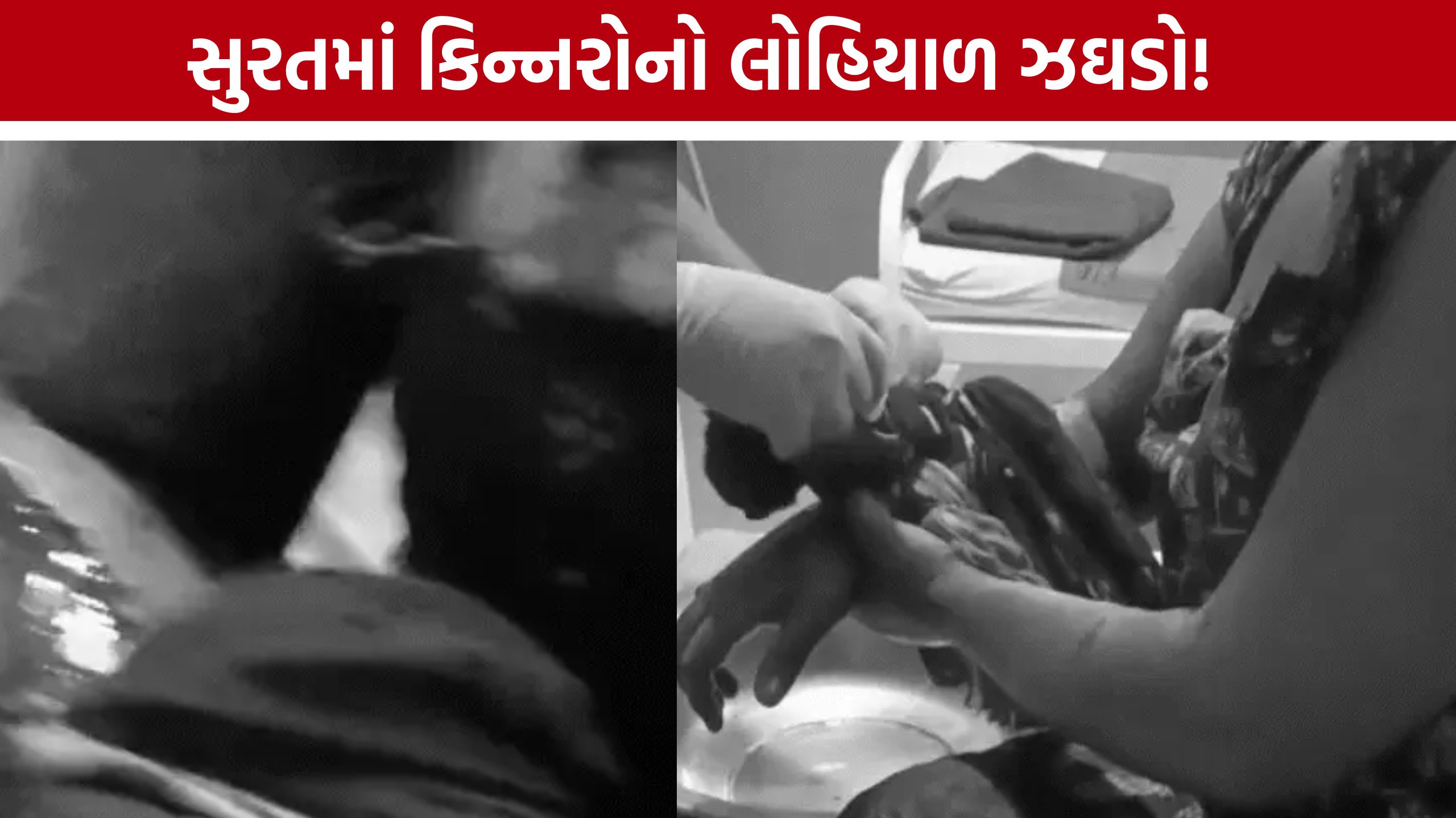 Kinnar Group Clash: જૂની અદાવતમાં સુરતમાં કિન્નર પર જીવલેણ હુમલો, લસકાણા પોલીસે તપાસ શરૂ કરી