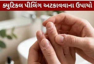 Cuticle peeling Preventive measures