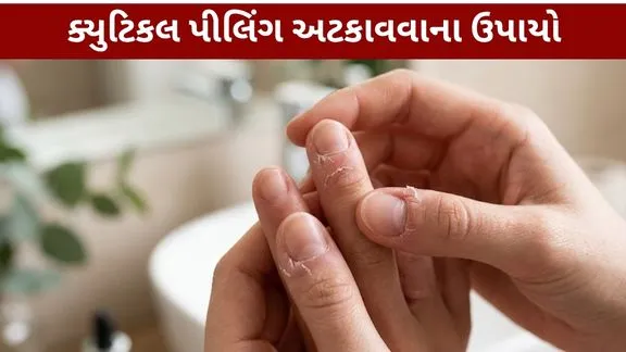 Cuticle peeling Preventive measures