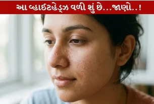 Whiteheads...ખીલ થવાની પ્રારંભિક અવસ્થા..!