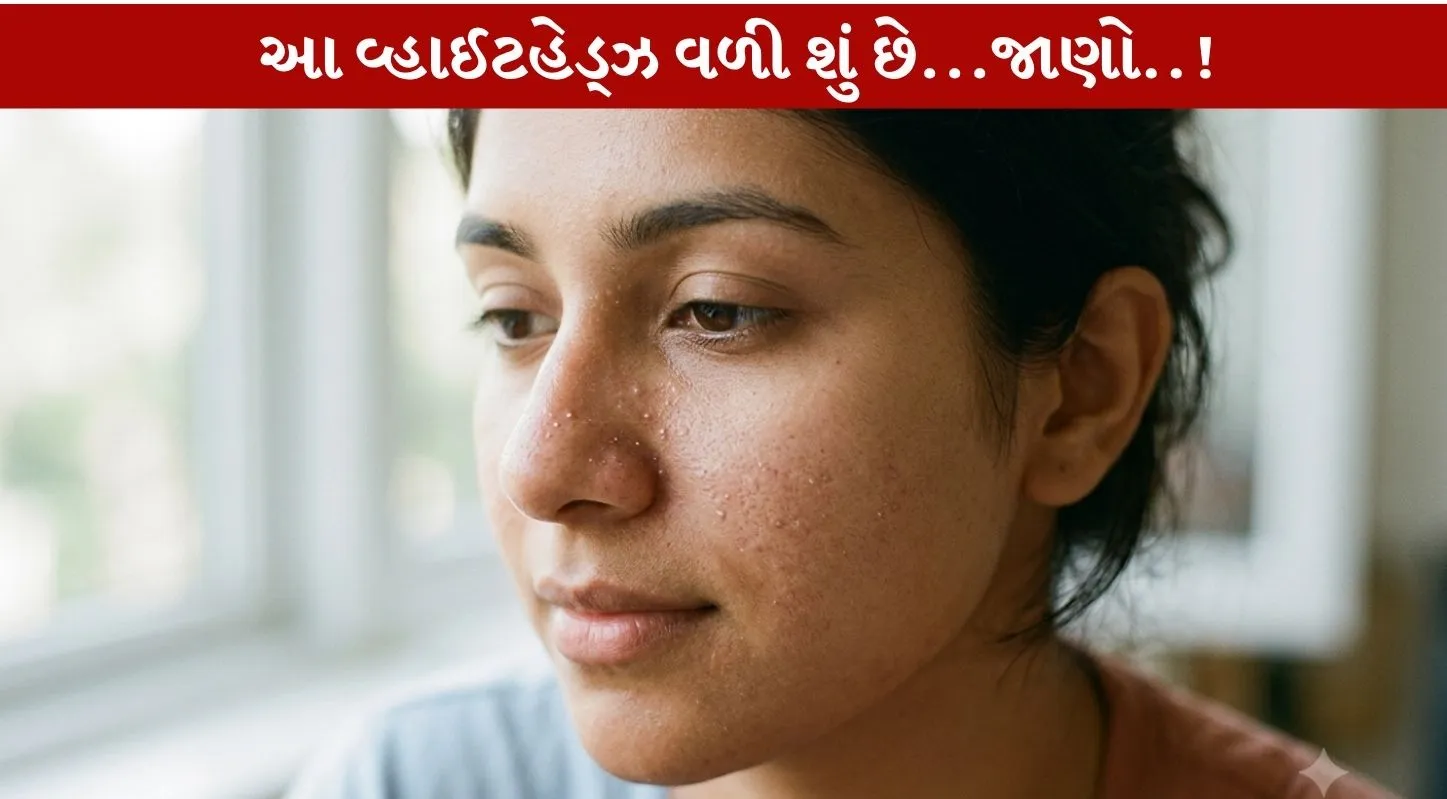 Whiteheads...ખીલ થવાની પ્રારંભિક અવસ્થા..!