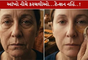 Wrinkles... જો આંખો નીચે દેખાય તો શા ઉપાયો કરશો?