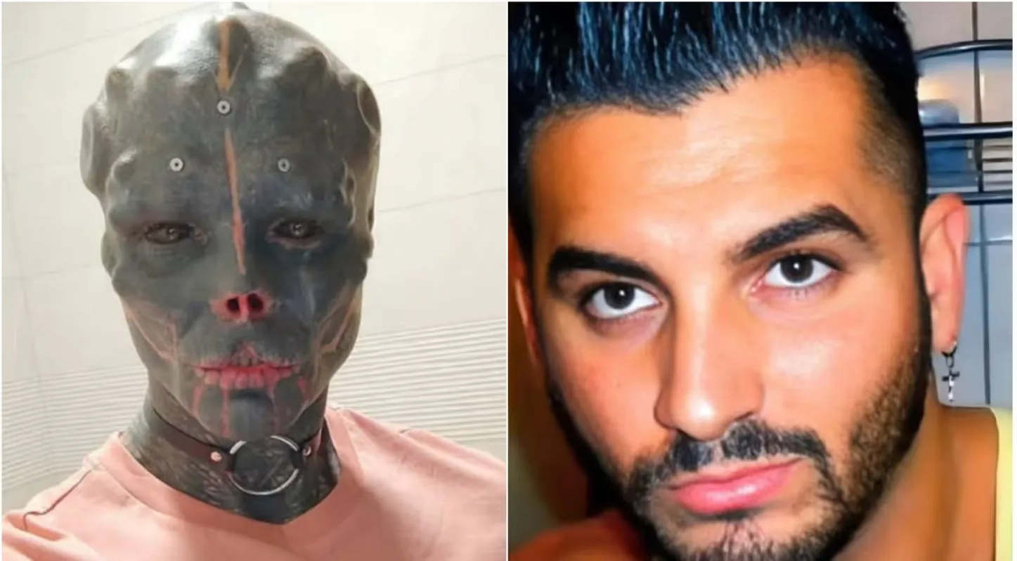 15 વર્ષ અગાઉ આવો દેખાતો હતો એન્થની Black Alien