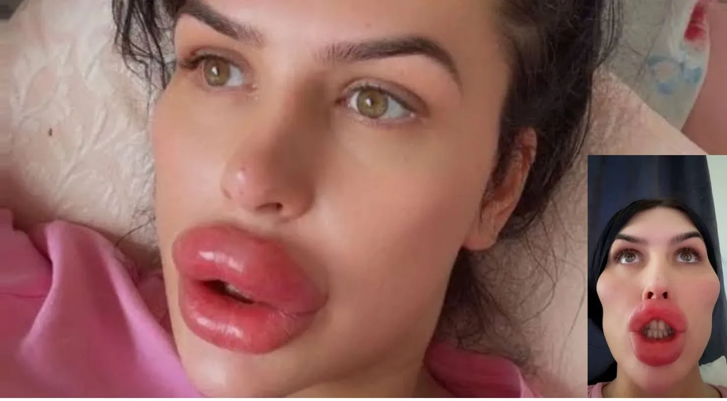British Model Sophia Did Self Surgery