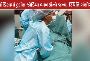 Odisha Conjoined Twins: જોડિયા બાળકોનો જન્મ, હૃદય અને લિવર એક જ