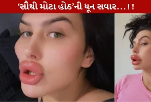 Sophia Lips સુર્ખીઓમાં...બ્રિટીશ મોડેલે જાતે જ 2 હોઠોની સર્જરી કરી! Shocking ઘટના વાયરલ....